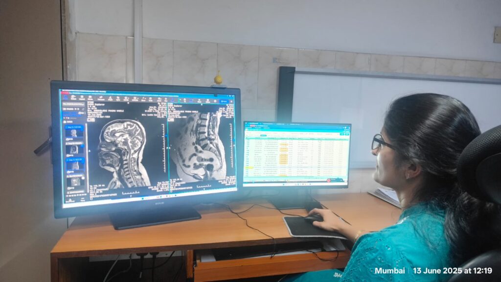 Neuro CT SCAN-Neuro Surgery-Holy Spirit Hospital
